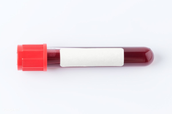Blood test tube transparent png | Free transparent png - 2296272 Blood test tube transparent png | Free transparent png - 2296272
