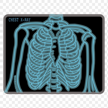 Chest X-ray png sticker, medical | Free PNG - rawpixel