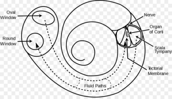 Cochlear implant Hearing Inner ear Psychology - ear Cochlear implant Hearing Inner ear Psychology - ear