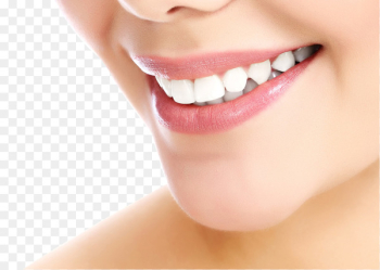 Cosmetic dentistry Smile Tooth whitening - US-tooth side Cosmetic dentistry Smile Tooth whitening - US-tooth side