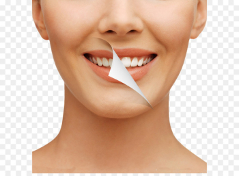 Cosmetic dentistry Tooth whitening Human tooth - Teeth Whitening 