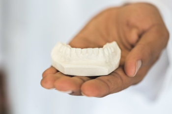 Dental Cast Dental Cast