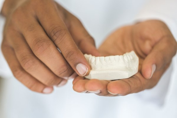Dental Casting Dental Casting