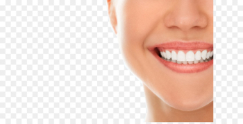 Dentistry Oral hygiene Dental implant Dental public health - Teeth model 