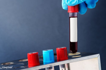Doctor holding a blood test tube transparent png | Free  transparent png - 2295553