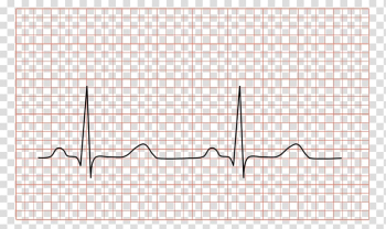 Electrocardiography QRS complex Medicine Cardiology Heart, electrocardiogram transparent background PNG clipart