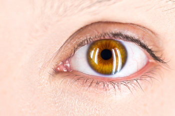 Free Photo of eye, human eye, focus Free Photo of eye, human eye, focus