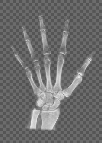 Hand CT scan png sticker, | Free PNG - rawpixel