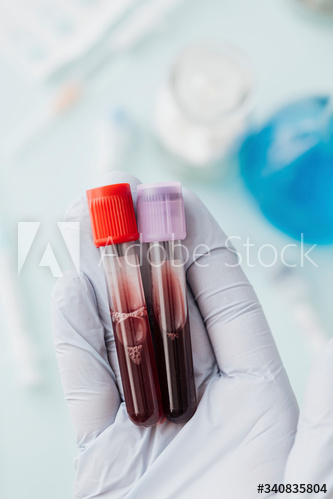 Hand of doctor holding blood test tubes during covid-19 outbreak Hand of doctor holding blood test tubes during covid-19 outbreak