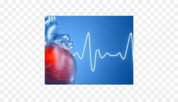 Heart arrhythmia Disease Cardiology Heart Ailment - heart Heart arrhythmia Disease Cardiology Heart Ailment - heart