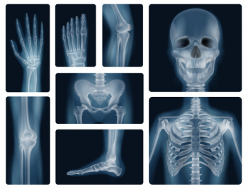 Human bones realistic x-ray shots Free Vector Human bones realistic x-ray shots Free Vector