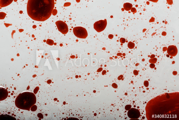 Infectious coronavirus blood splatter Infectious coronavirus blood splatter