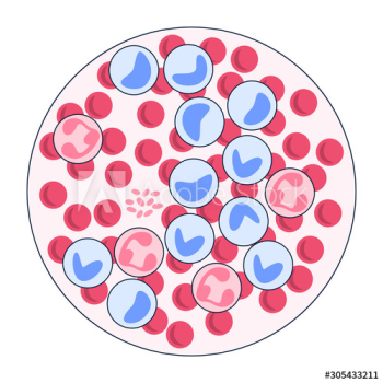 Leukemia examination concept Leukemia examination concept