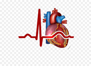 Myocardial infarction Heart Cardiovascular disease Symptom - heart, 