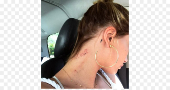 Nape Neck Photography Paris Fashion Week - Hailey Baldwin Nape Neck Photography Paris Fashion Week - Hailey Baldwin