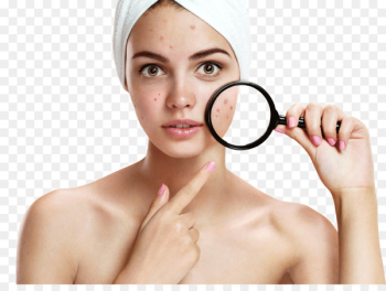 Pimple Acne Benzoyl peroxide Therapy Skin - powder effect Pimple Acne Benzoyl peroxide Therapy Skin - powder effect