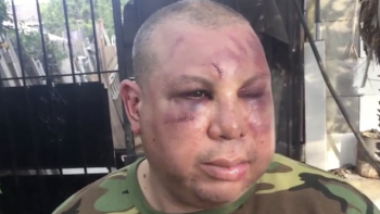 Police officers arrested, fired after allegedly beating up Latino ...