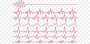 Red Heart rate Electrocardiography Monitoring - Red heartbeat line 