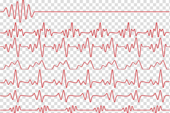 Red heart rate illustration, Red Heart rate Electrocardiography Monitoring, Red heartbeat line transparent background PNG clipart