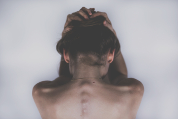 Skin and bones Skin and bones