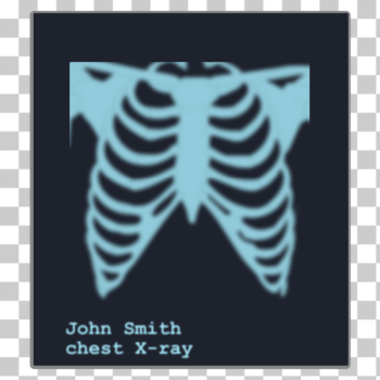 SVG Chest X-ray image SVG Chest X-ray image