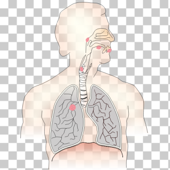 SVG Symbol for lung cancer vector image SVG Symbol for lung cancer vector image
