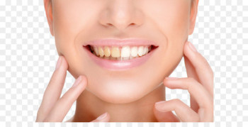 Tooth whitening Human tooth Cosmetic dentistry - Teeth whitening 