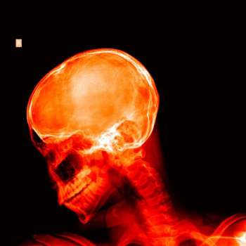 X-ray of a skull - Red on black X-ray of a skull - Red on black