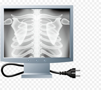 X-ray Rib Bone Cartoon - Check bones 