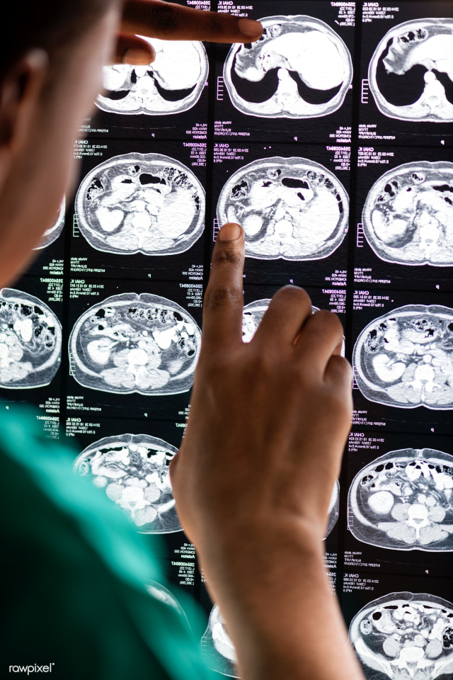 Doctor reading brain MRI x-ray result | Free stock photo - 380343