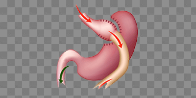 The Connection Between Lemon Water and Weight Loss