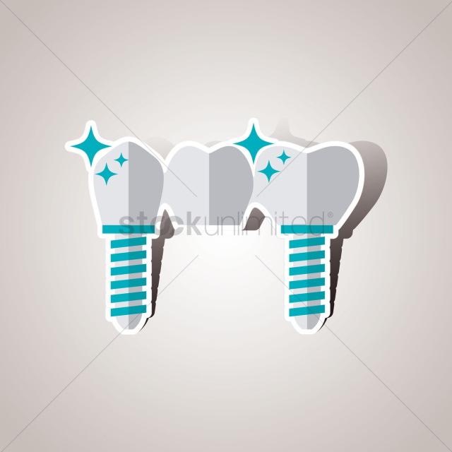 Tooth implants
