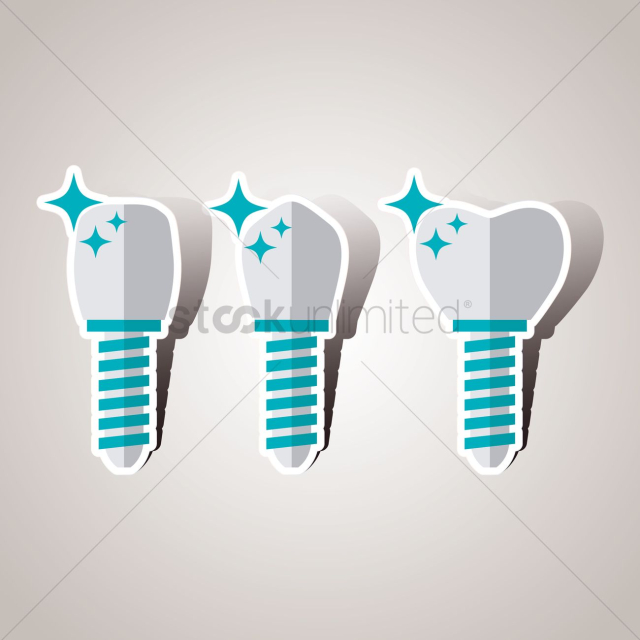 Tooth implants
